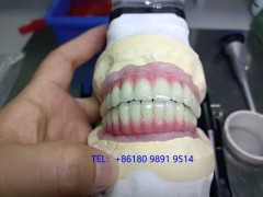 種植牙Dental Implant外貿(mào)出口